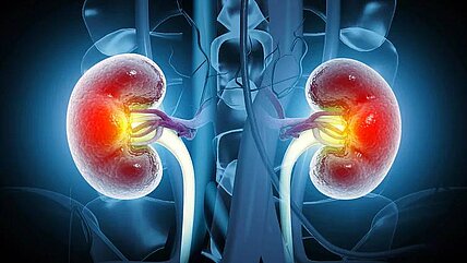 Prostaglandine gegen Nierenleiden