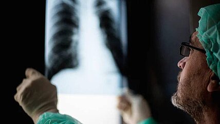 Bis heute ein Schreckgespenst: Tuberkulose