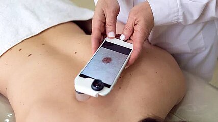 Die UV-Therapie ist bei vielen Haut­erkrankungen sehr gut wirksam 
